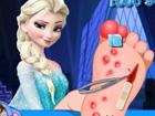 Elsa Foot Sugery - Frozen 