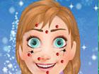 Anna Face Cleaning - Frozen games 