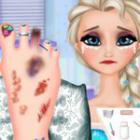 Game Elsa Foot Injured - over 4000 free online games